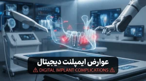 عوارض ایمپلنت دیجیتال