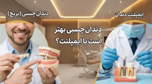 دندان چسبی بهتر است یا ایمپلنت