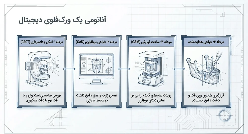 مراحل ایمپلنت دیجیتال
