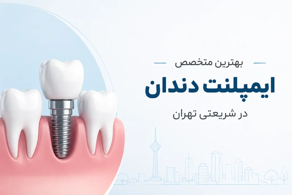 بهترین متخصص ایمپلنت در شریعتی تهران