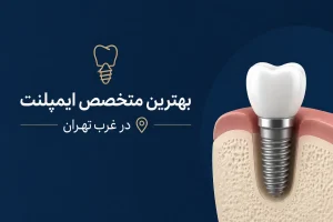 بهترین متخصص ایمپلنت در غرب تهران