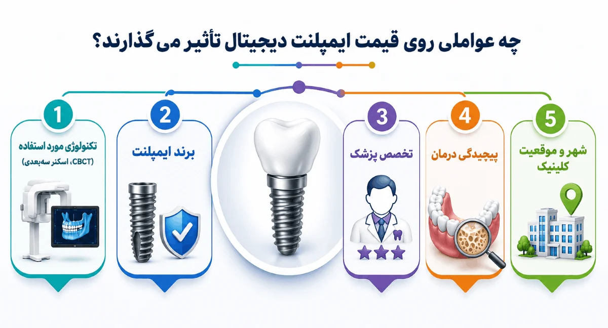 عوامل موثر بر قیمت ایمپلنت دیجیتال 