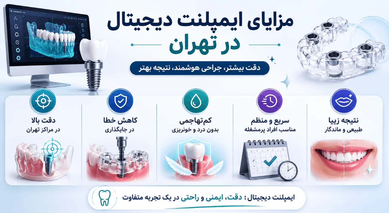 مزایا ایمپلنت دیجیتال در تهران