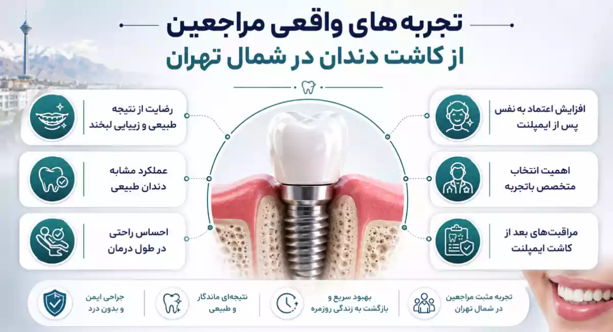 تجربه بیماران از ایمپلنت در زعفرانیه تهران