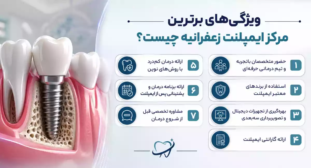 ویژگی های بهترین مرکز ایمپلنت زعفرانیه تهران
