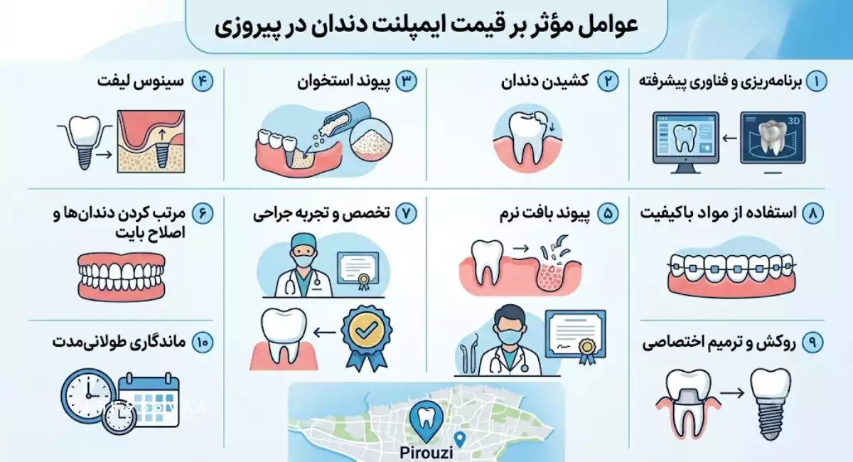 عوامل موثر بر هزینه ایمپلنت در پیروزی تهران