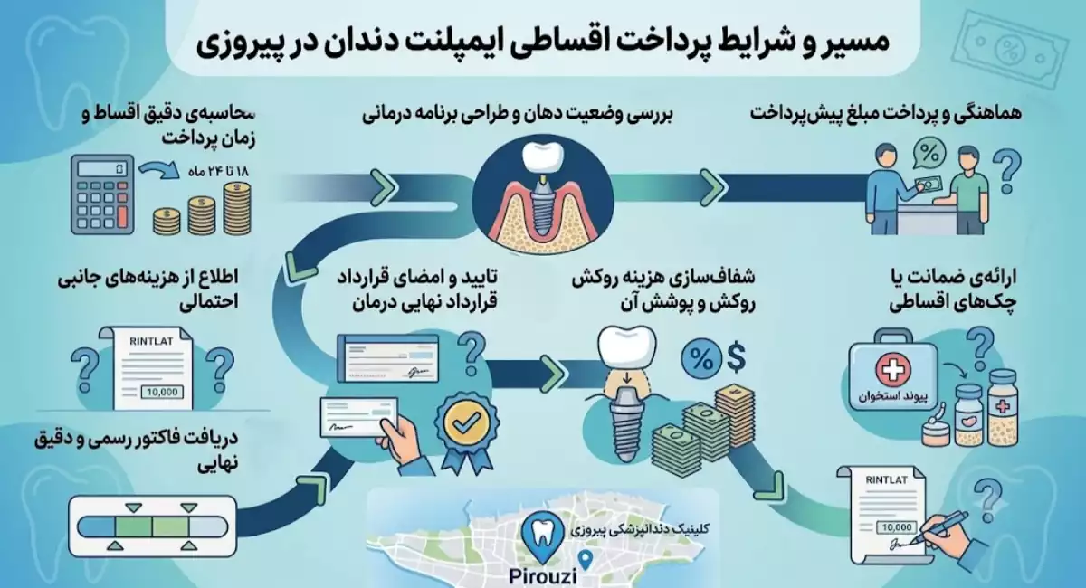 شرایط پرداخت قسطی ایمپلنت در پیروزی تهران