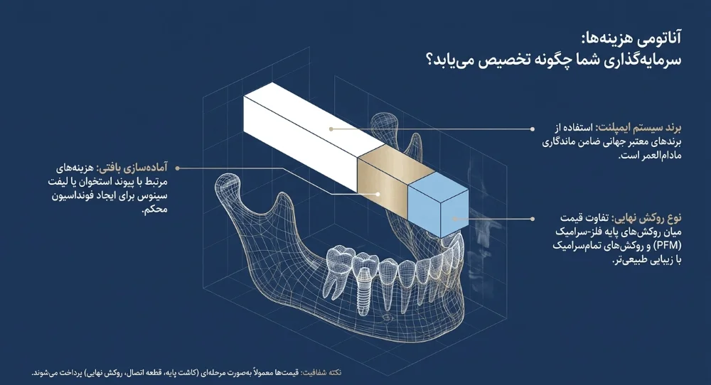 قیمت ایمپلنت در شرق تهران