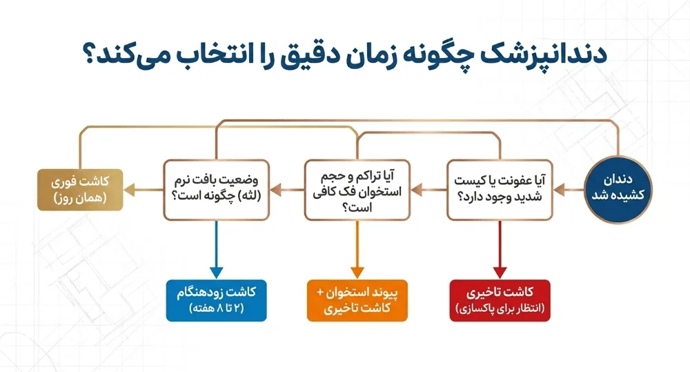 چه مدت بعد از کشیدن دندان باید ایمپلنت کرد