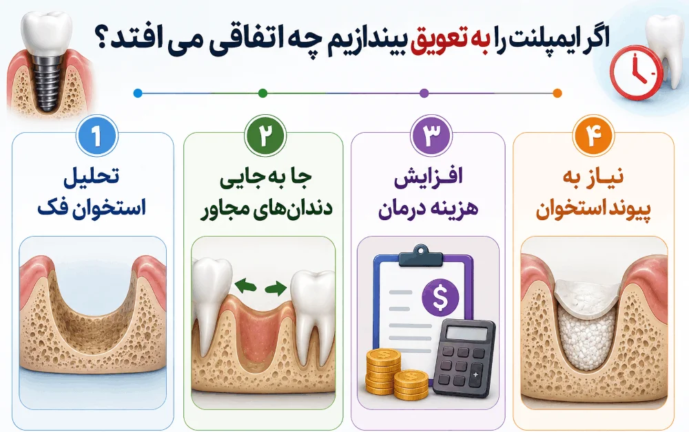 عواقب به تاخیر انداختن ایمپلنت
