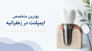 بهترین متخصص ایمپلنت در زعفرانیه
