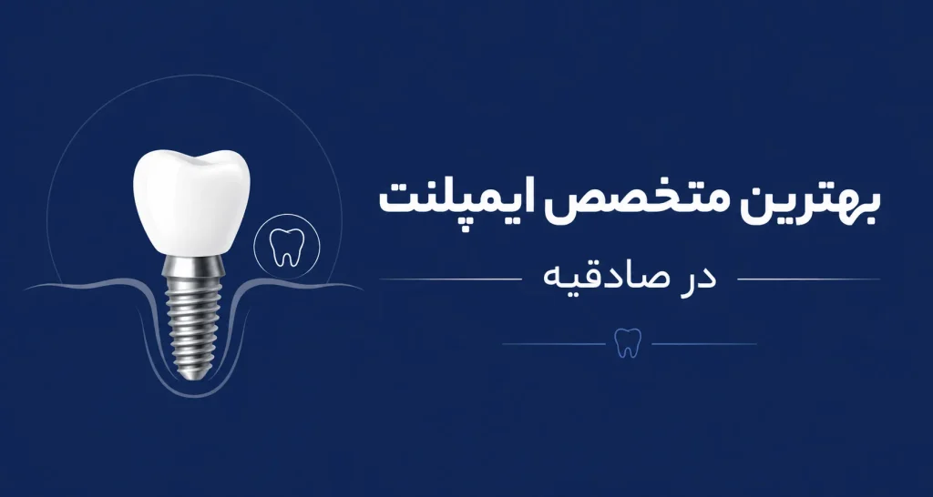 بهترین متخصص ایمپلنت در صادقیه