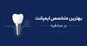 بهترین متخصص ایمپلنت در صادقیه