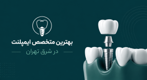 بهترین متخصص ایمپلنت در شرق تهران
