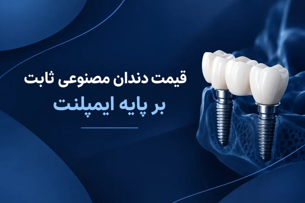 قیمت دندان مصنوعی ثابت بر پایه ایمپلنت
