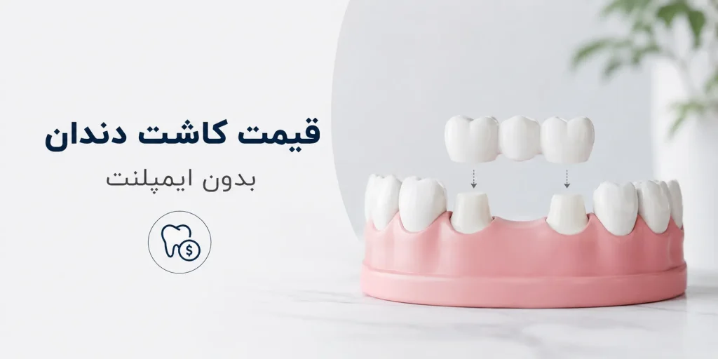 قیمت کاشت دندان بدون ایمپلنت