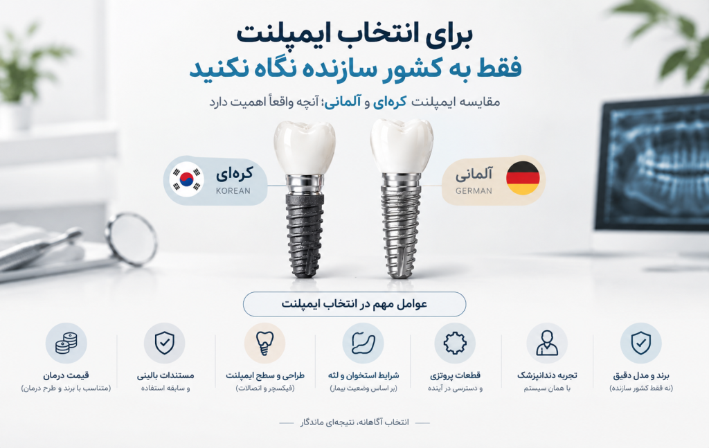مقایسه ایمپلنت کره ای و آلمانی