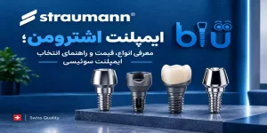 ایمپلنت اشترومن