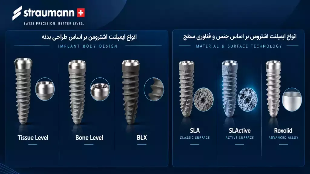 انواع ایمپلنت اشترومن بر اساس جنس و فناوری سطح و طراحی بدنه
