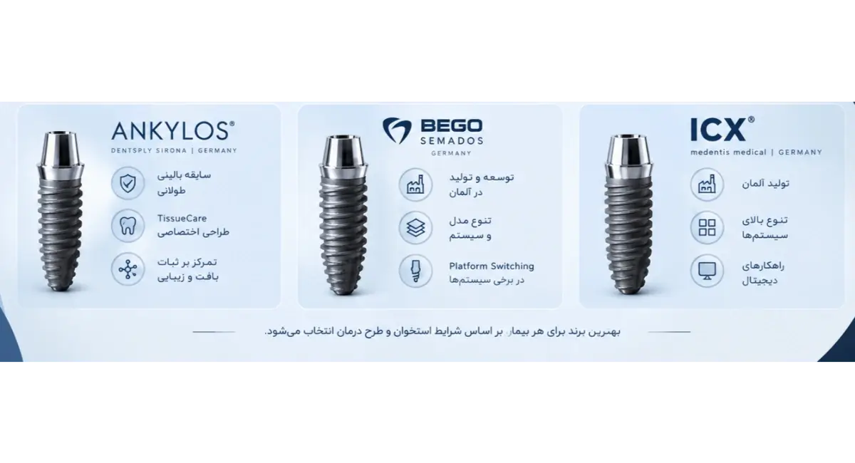 بهترین برند ایمپلنت آلمانی کدام است؟