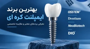بهترین برند ایمپلنت کره ای