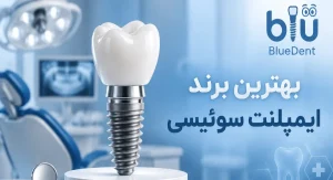 بهترین برند ایمپلنت سوئیسی کدام است؟
