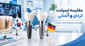مقایسه ایمپلنت آلمانی و کره ای