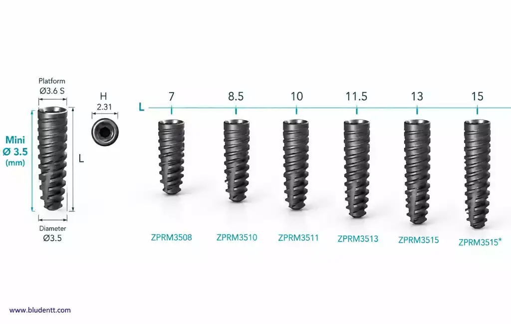 فیکسچر ایمپلنت Izen چه ویژگی‌ هایی دارد؟