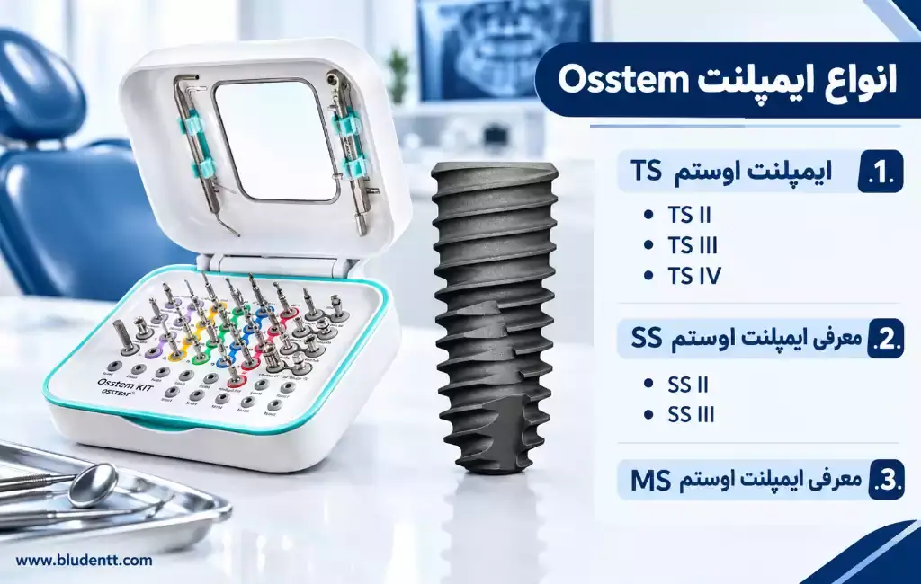 انواع ایمپلنت Osstem