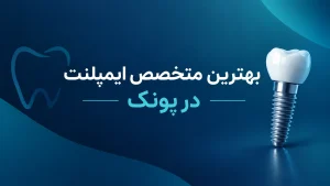 بهترین متخصص ایمپلنت در پونک