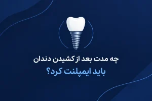 چه مدت بعد از کشیدن دندان باید ایمپلنت کرد؟