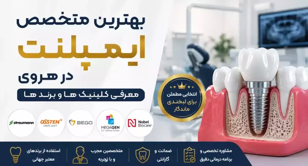 بهترین متخصص ایمپلنت در هروی