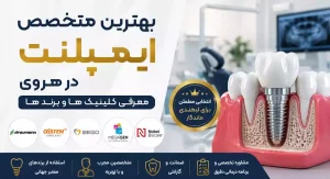 بهترین متخصص ایمپلنت در هروی