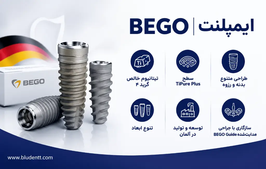 ایمپلنت BEGO چیست