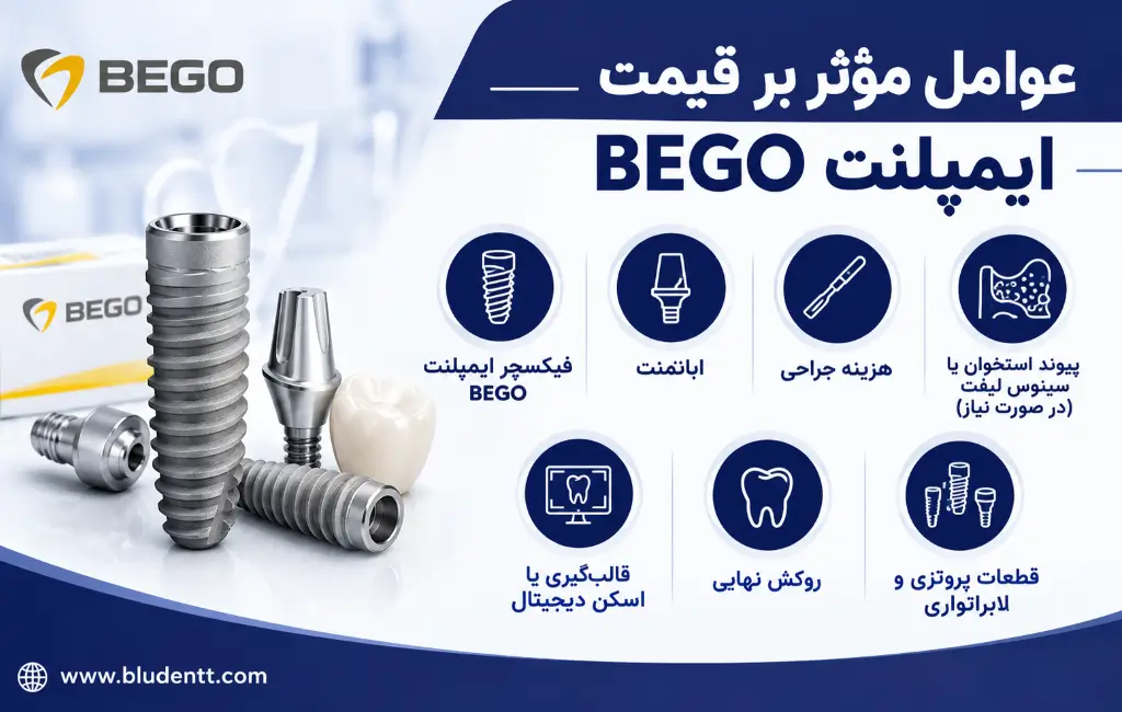 عوامل موثر بر قیمت ایمپلنت BEGO