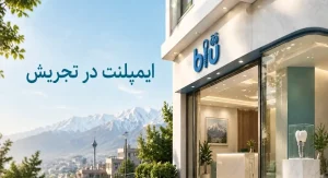 لیست بهترین متخصص ایمپلنت در تجریش