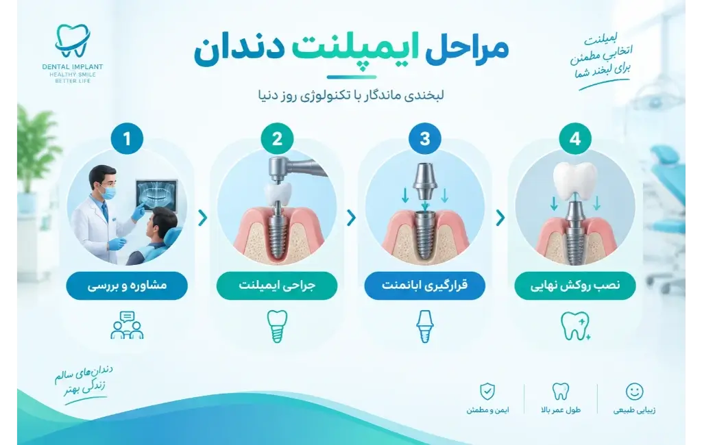 مراحل ایمپلنت دندان