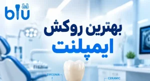 بهترین برند روکش ایمپلنت