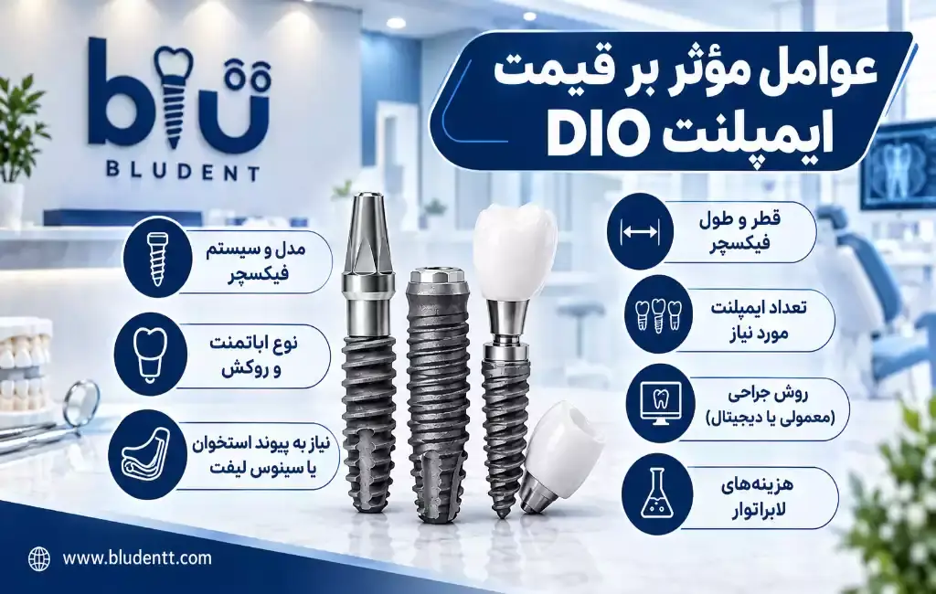 قیمت ایمپلنت دیو از چه عواملی تاثیر می‌گیرد؟